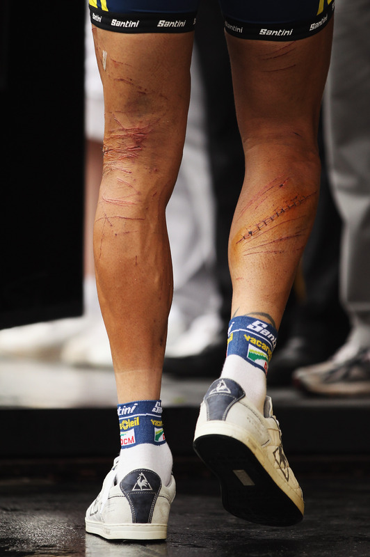 hoogerlands legs.jpg