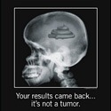 tumor.jpg
